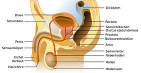 Fleisch, Milchprodukte, raffiniertes Getreide und Zucker stellen ein Risiko für Prostatakrebs dar